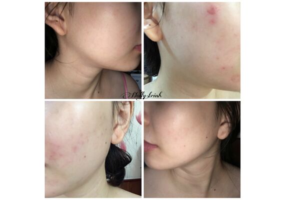 BioDerma Cicabio Cream Soothing Reparing Cream 40ml - Δερματικές Καταστάσεις στο Dvcare